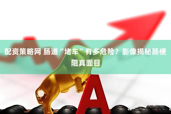 配资策略网 肠道“堵车”有多危险？影像揭秘肠梗阻真面目